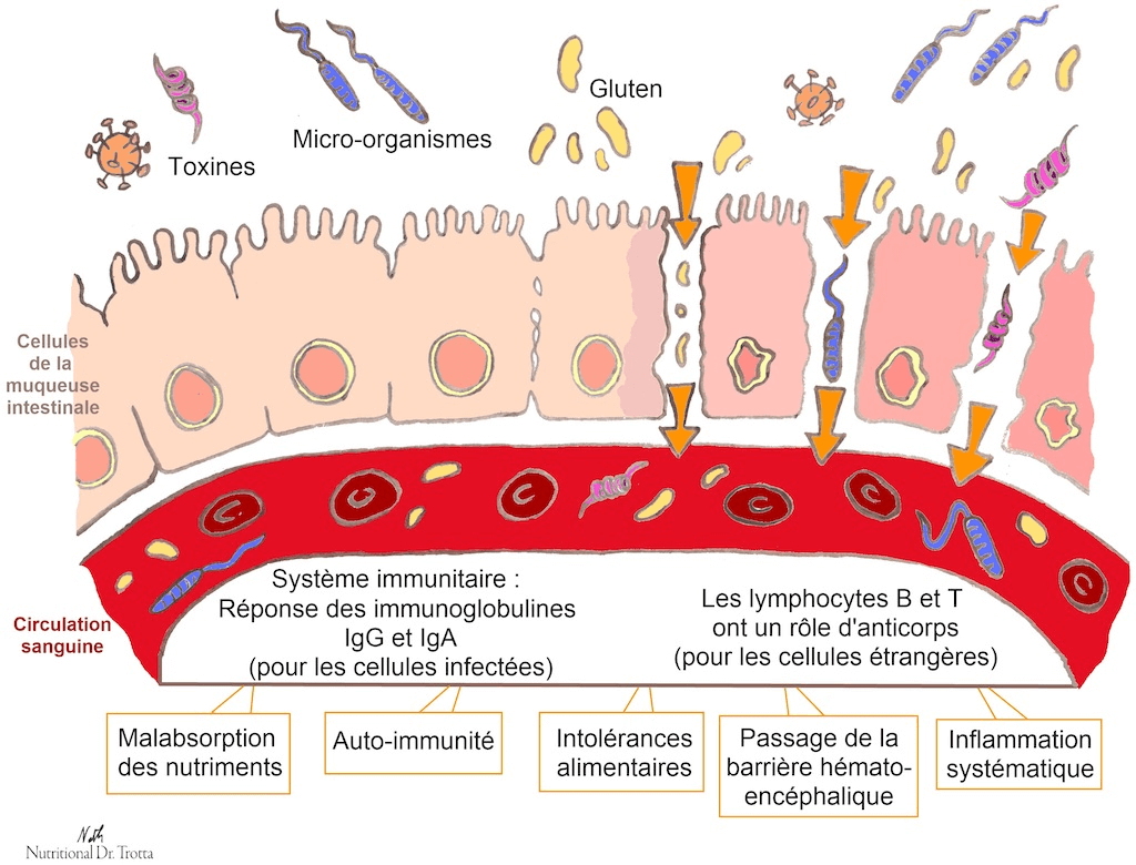 schema